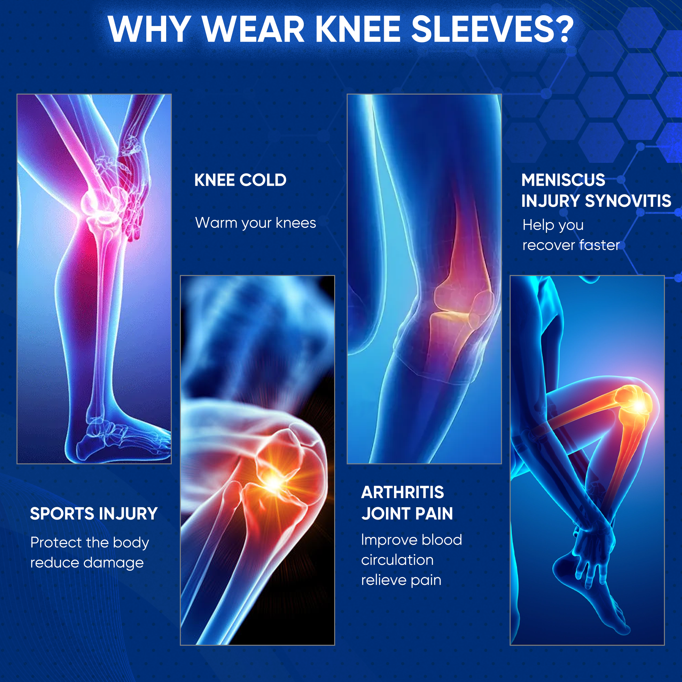 KHNYX Copper Knee Brace and Support Compression Sleeve Breathable Pad for Running, Arthritis, Meniscus Tear, Sports, Joint Pain, L